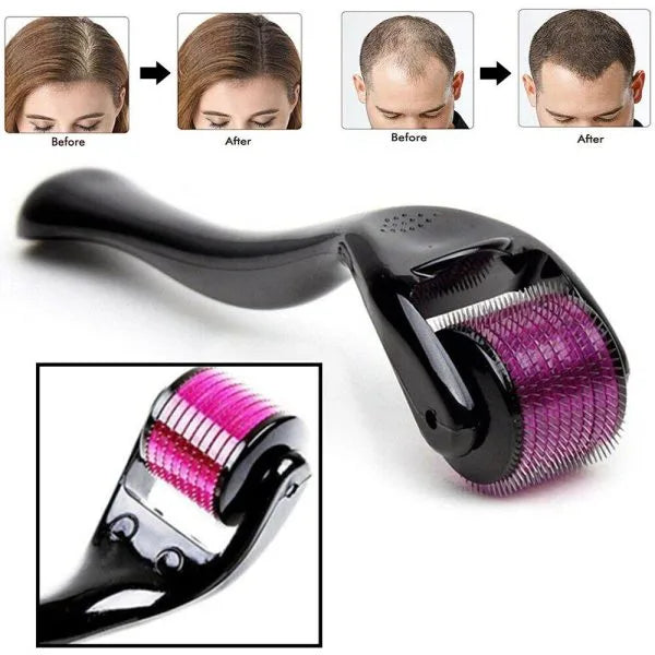 Derma Roller Facial & Hair Therapy Microneedle Hair Regrowth Beard Growth Anti Hair Loss Treatment Thinning ( 1.5mm )